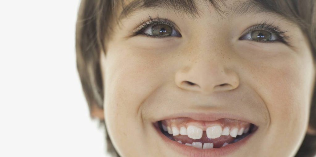 ALGUNOS BULOS SOBRE LOS DIENTES DE NUESTROS HIJOS