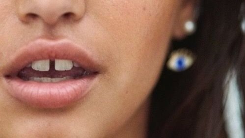 Diastemas: el espacio entre los dientes que está de moda