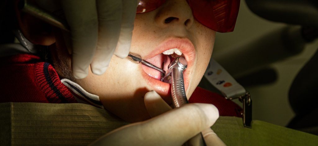 Caries: ¿Qué Es Y Cómo Podemos Solucionarla?