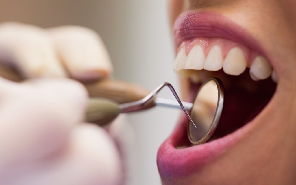 Periodontitis: Cómo Mantener tus Encías Sanas