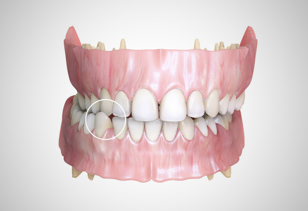 odontología infantil en Burgos