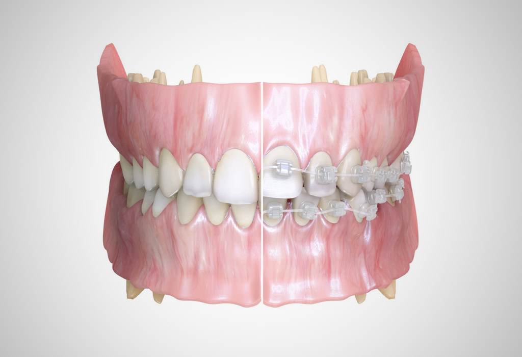 odontología infantil en Burgos